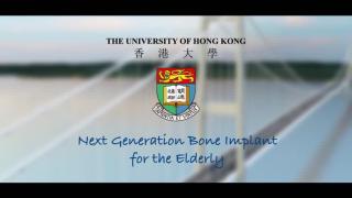 Knowledge Exchange Video: Next Generation Bone Implant for the Elderly