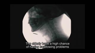 KE Video: Technology-based Management of Swallowing Difficulties