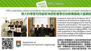 HKU scientists utilise innovative neuroimaging approach to unravel complex brain networks